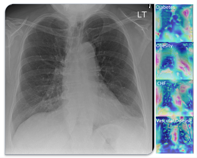 Lung scans from a COVID-19 patient.